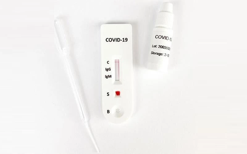 Uzak Doğu’dan ithal edilen antikor test kitlerindeki tehlike
