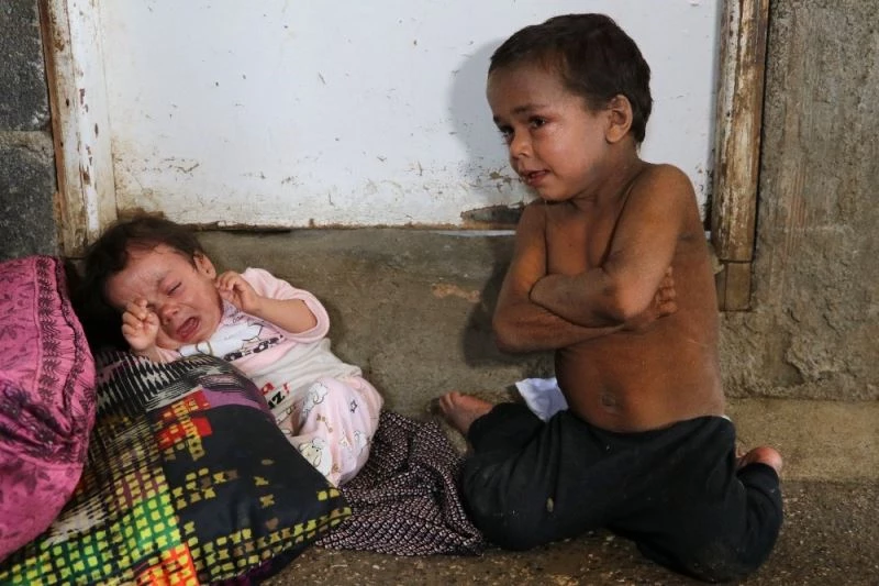 Balık pulu hastası kardeşler yardım bekliyor
