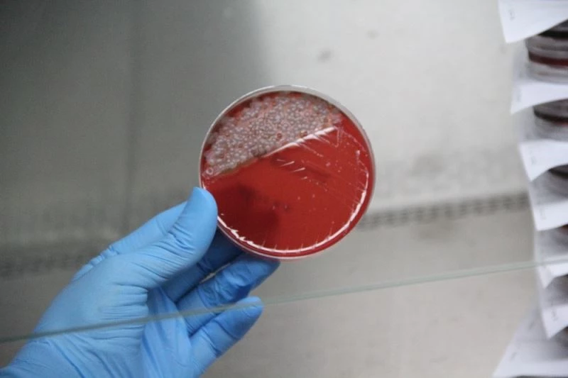 Uzun süre kullanılan maskedeki bakteriler laboratuvarda gözler önüne serildi
