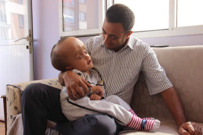 Minik Sercan’ın kafası küçülmeye başladı
