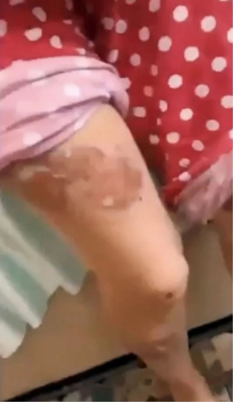 Eşine kızgın bıçakla işkence uyguladığı iddia edilen şüpheli tutuklandı
