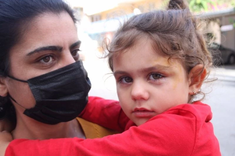 (Özel) Sokak köpeğini severken neredeyse gözünden oluyordu
