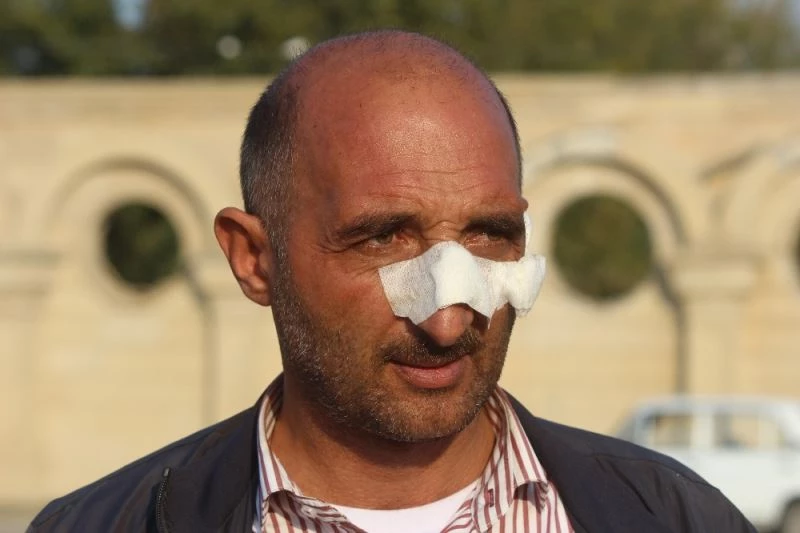 Berde’deki roketli saldırıda yüzünden yaralanan Ağalarov korku dolu anları anlattı
