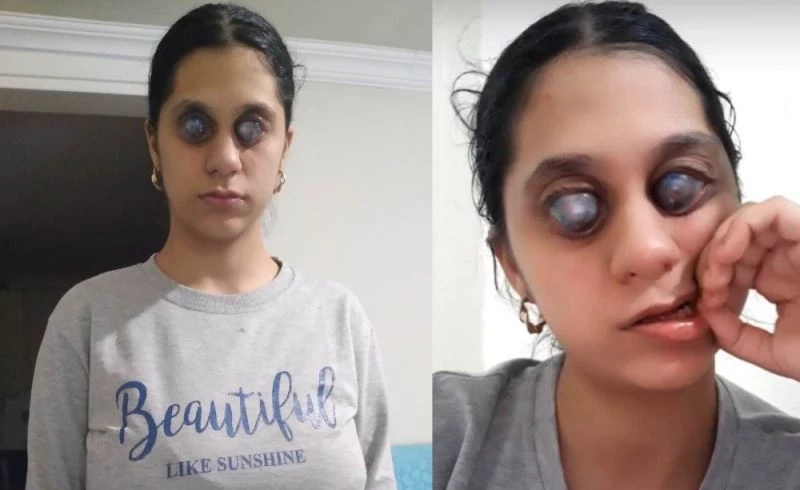 Ümran için Bakanlık harekete geçti
