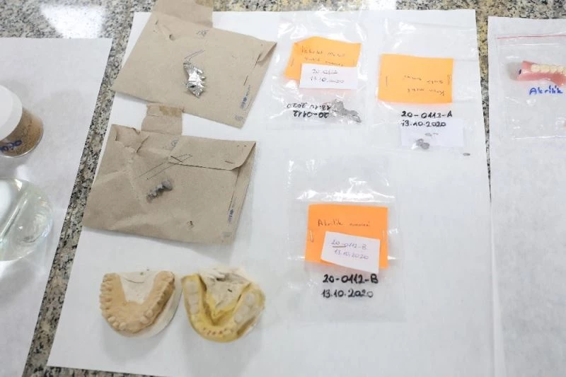 Dokuz Eylül’den diş protezi analizi için yerli referans malzeme
