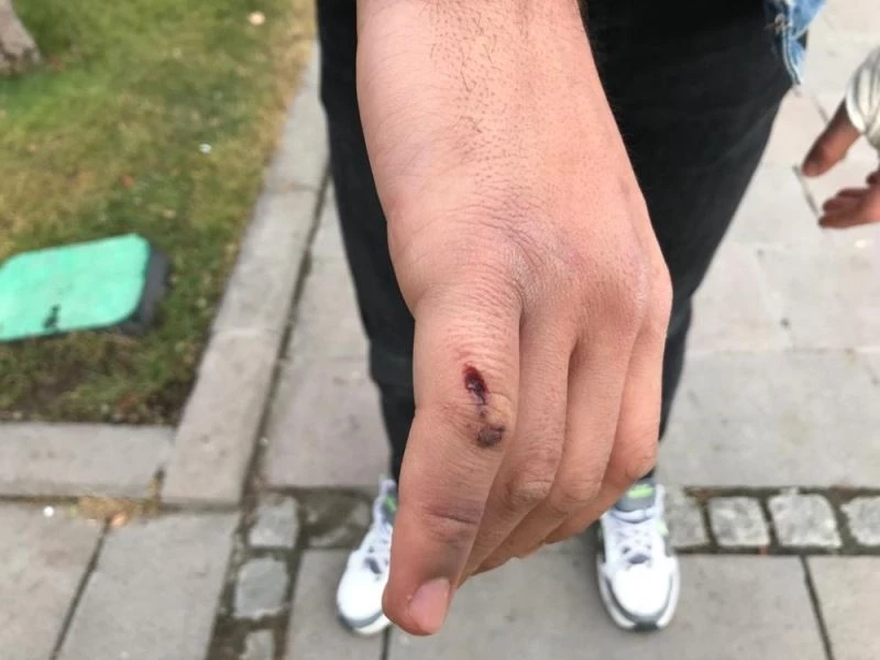 “Canım acıdı” denilerek darp edilen sağlıkçı o anları anlattı
