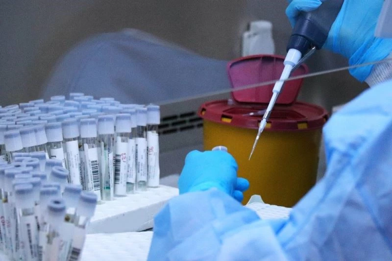 Samsun’da günlük test kapasitesi ise 5 binden 7 bine yükseltildi
