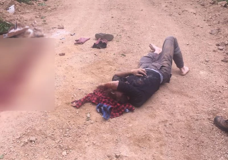 Elektrik direğinden düşen genç yaşam savaşı veriyor
