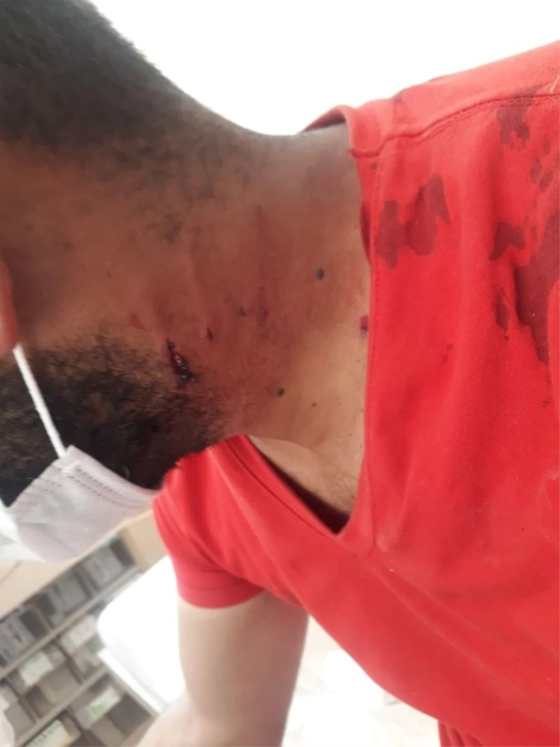 Köpeğin saldırdığı adam boynundan ve kolundan yaralandı
