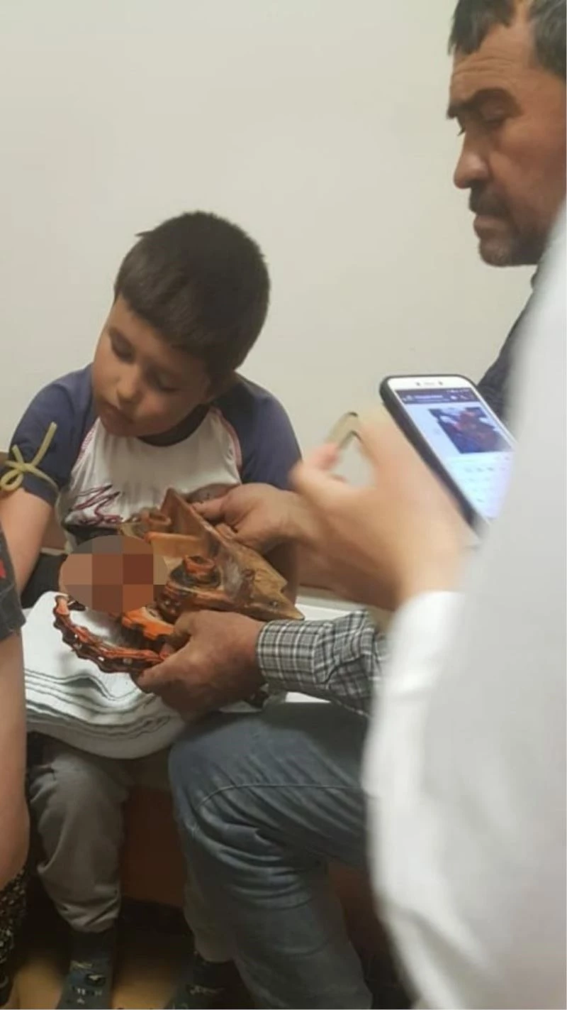 Elini kaptırdığı makine ile 60 kilometre uzaklıktaki hastaneye götürüldü
