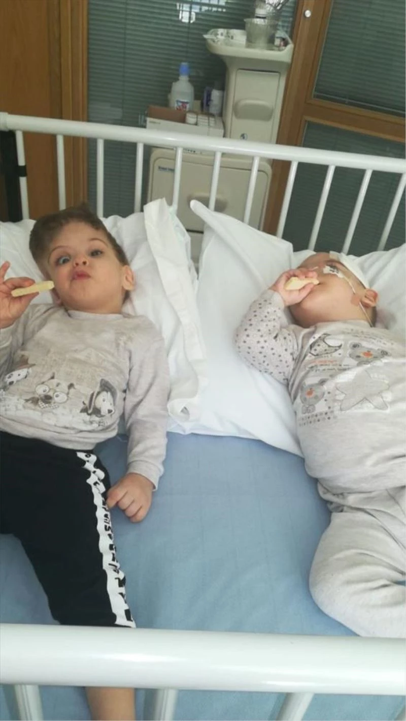 Siyam ikizlerine hayat veren operasyon