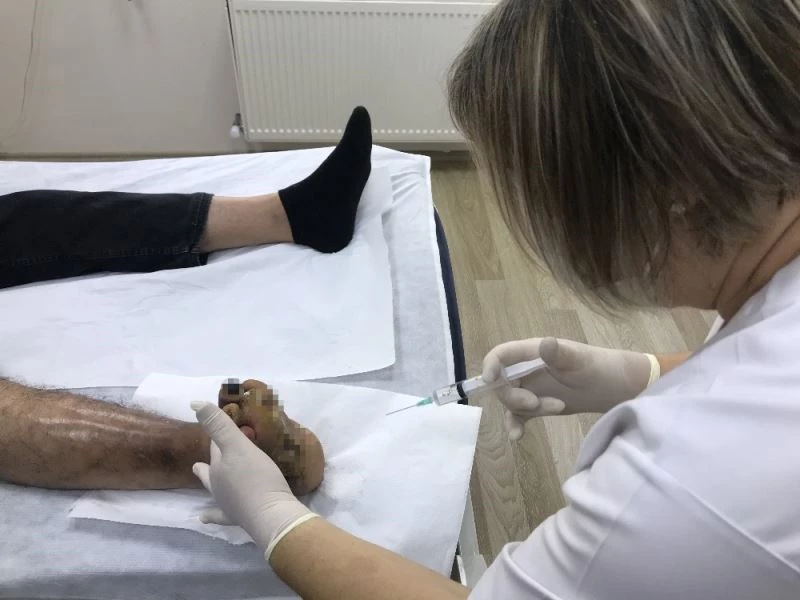 (Özel) Ozon tedavisiyle ayak yaralarından kurtuluyor

