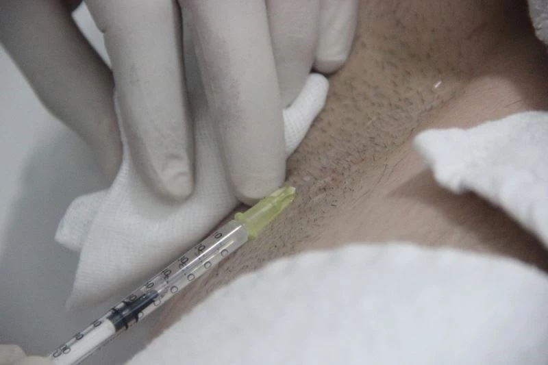 Yaz aylarının kabusu, terlemeye karşı botokslu çözüm
