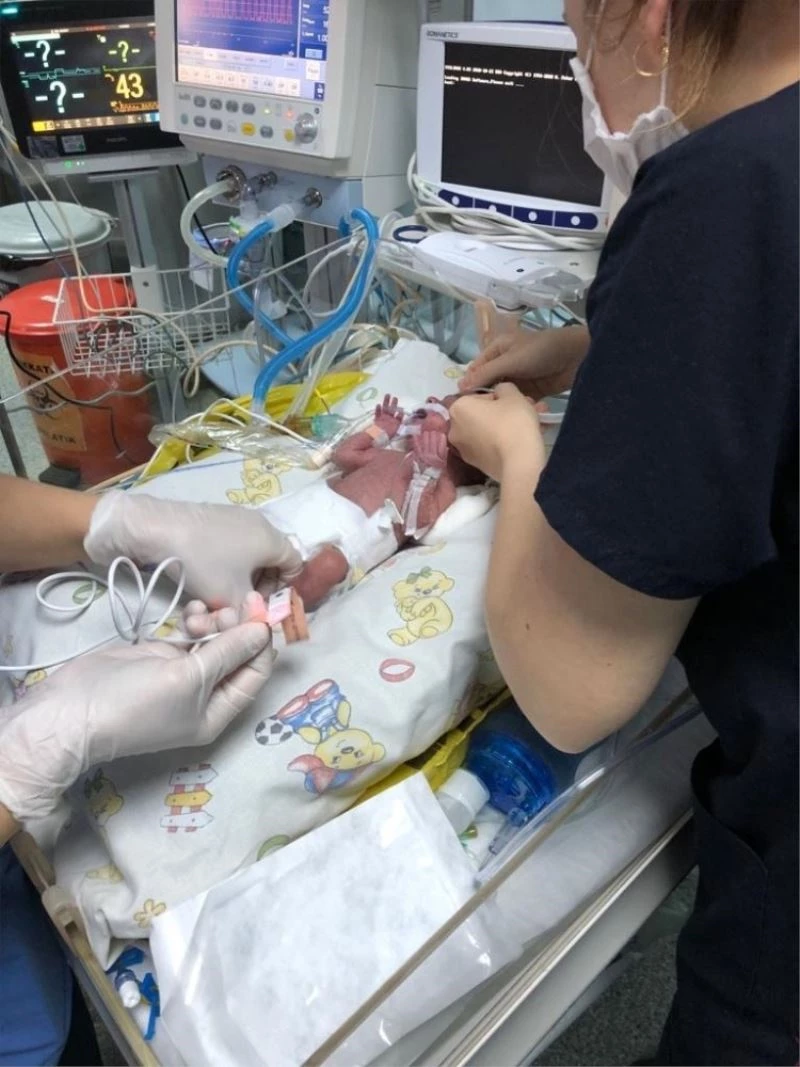 (Özel) Prof. Dr. Cemil Taşcıoğlu Şehir Hastanesi’nde ilk kalp ameliyatı
