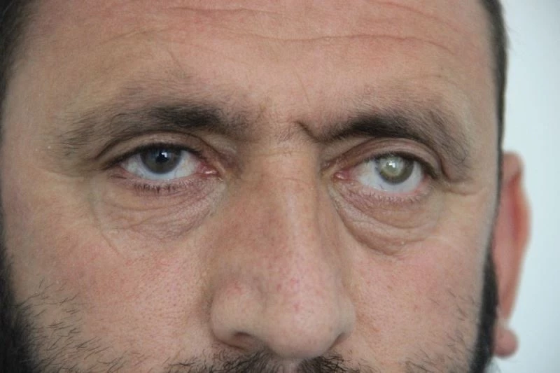 Eşini son günlerinde göremedi, kızının yüzünü görebilmek için 600 bin TL’ye ihtiyacı var
