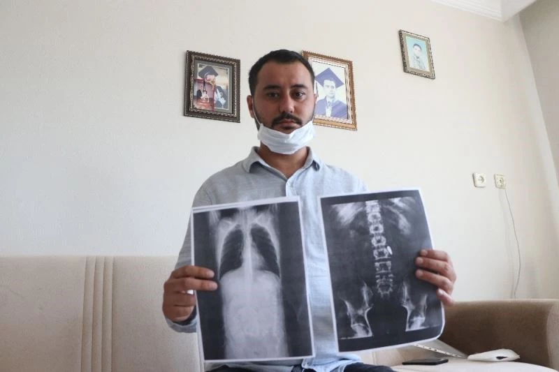 15 Temmuz gazisi. 4 yıldır vücudunda hainlerin sıktığı mermiyle yaşıyor
