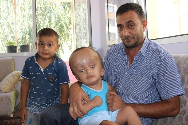 Minik Sercan’ın hayatı 240 bin TL’ye bağlı
