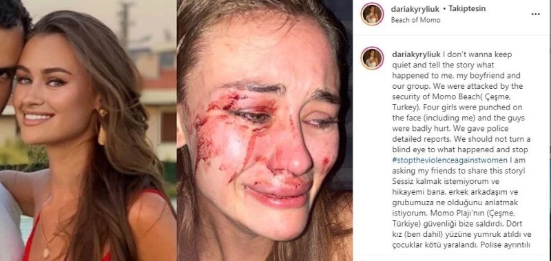 Ukraynalı top modelin darp iddiası yargıya taşınıyor
