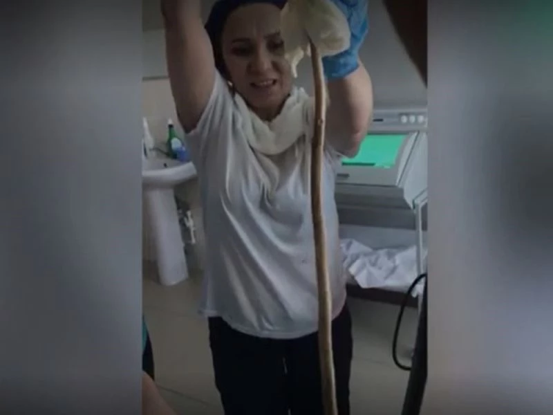 Rusya’da uyuyan kadının ağzından giren yılan ameliyatla çıkarıldı
