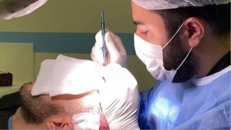 Million Hair Center CEO’su Fatih Köse: “Saç ekimi yaptırmak isteyenlerin sayısı artacak”
