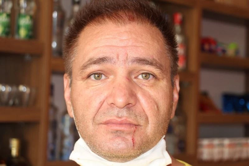 Antalya’da gurbetçi işletmeciye sandalyeli, tekmeli tokatlı  darp kamerada
