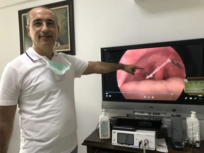 Balık sezonu açıldı, kılçık batması şikayetleri arttı
