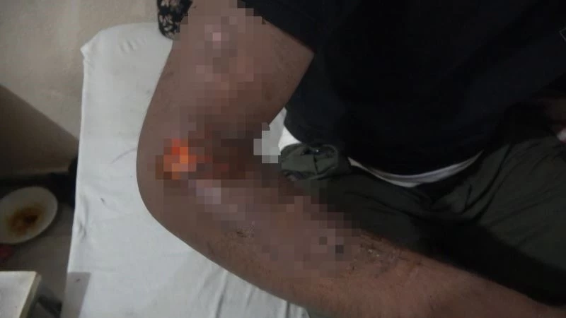 (Özel) Avrupa ümidiyle Yunanistan’a gittiler, işkence edilerek geri gönderildiler
