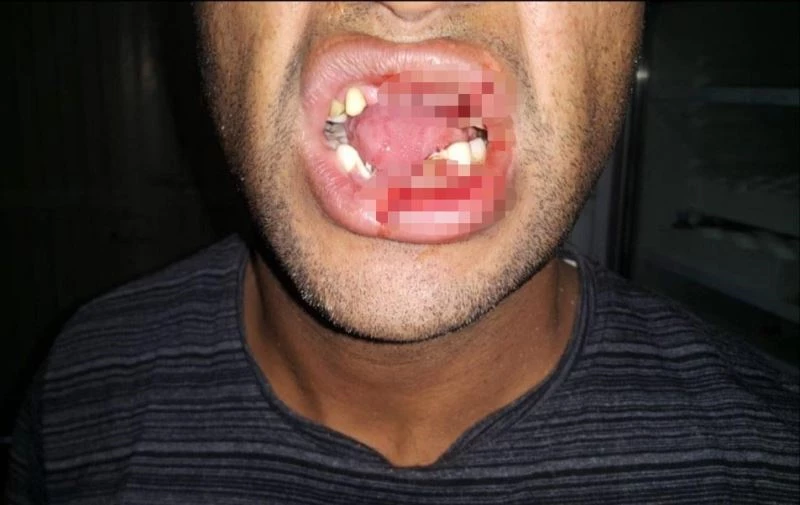 Huysuz inek veterinerin çenesini kırdı
