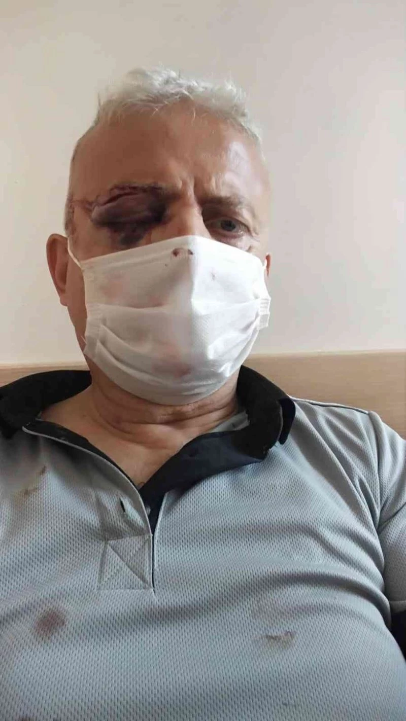 Metrobüste maske uyarısı yapan güvenlik görevlisini kör eden sanık hakkında iddianame hazırlandı
