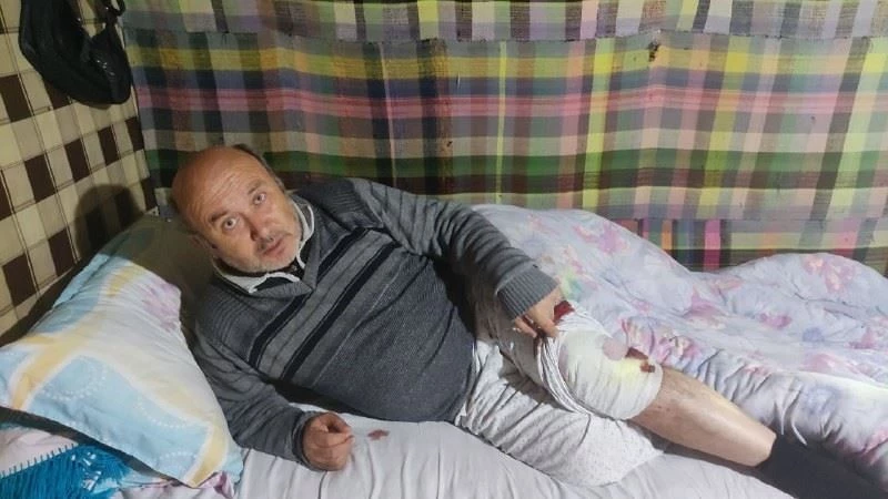 Karşısına çıkan ayıyla boğuşan adam o dehşet anlarını anlattı
