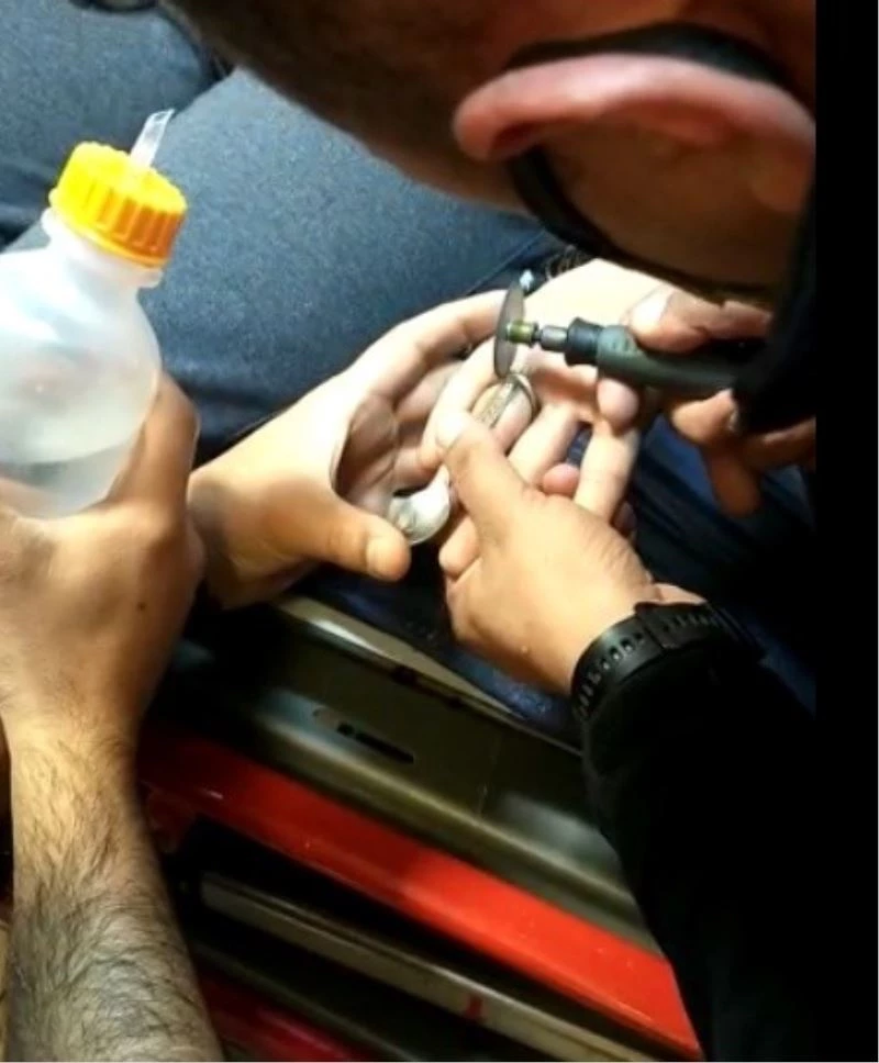 Parmağına sıkışan madeni paradan yaptığı yüzüğü itfaiye çıkarttı
