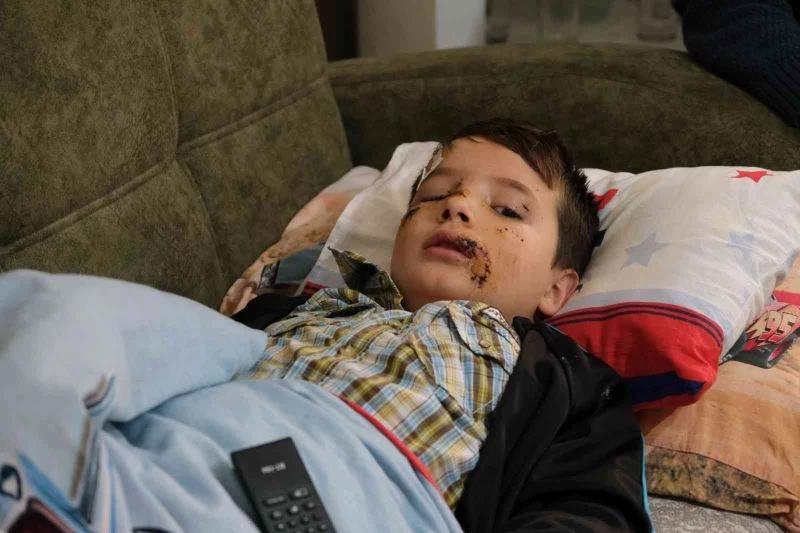 Sokak köpeğinin saldırısına uğrayan çocuk ölümden döndü
