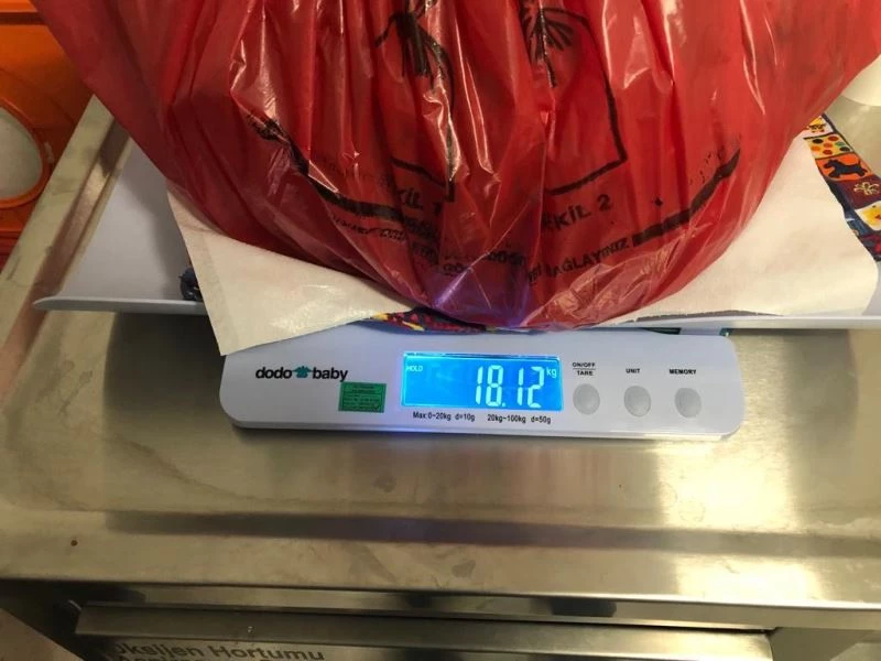 Karın şişliği sandı, 18 kiloluk kitle çıktı
