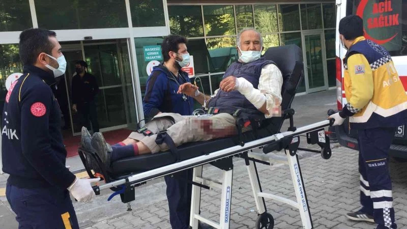 Odun kesmek isterken kolunu kesti
