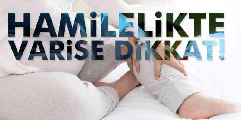 Hamilelikte varis gelişimine dikkat
