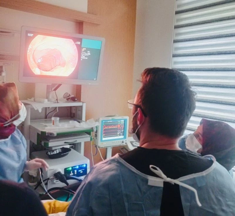 Ayancık’ta endoskopi ve kolonoskopi işlemleri başladı
