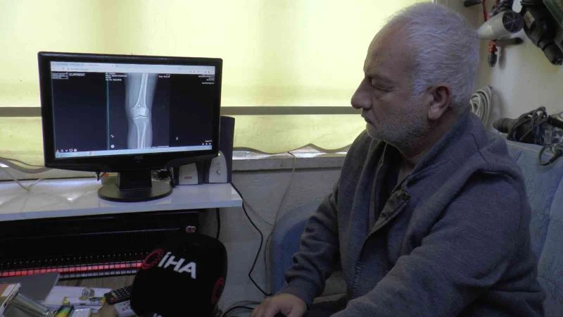 Diz kapağındaki mermi 13 gün sonra fark edildi

