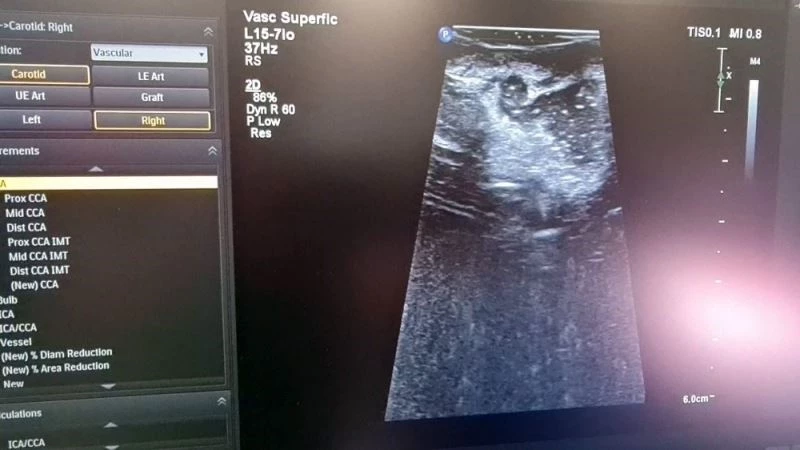 Cumhurbaşkanı Erdoğan’ın açılışını yapmıştı, Hibrit Ameliyathanede ilk ameliyat gerçekleştirildi
