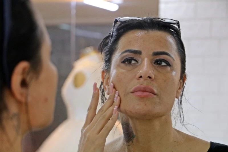 Güzelleşmek isterken yüzünde yanıklar oluşan kadın: 