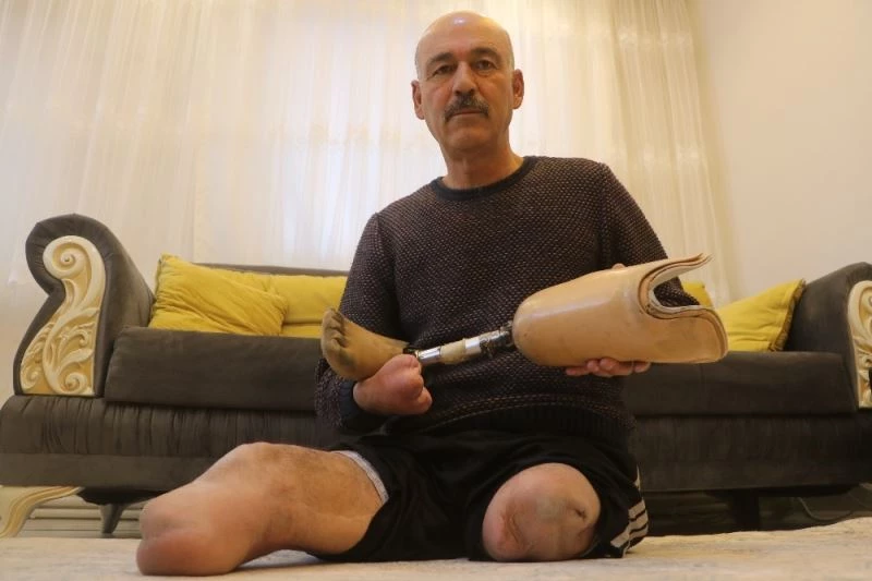 Defalarca ameliyat oldu, iki bacağını bir elini kaybetti, yine de hayata küsmedi
