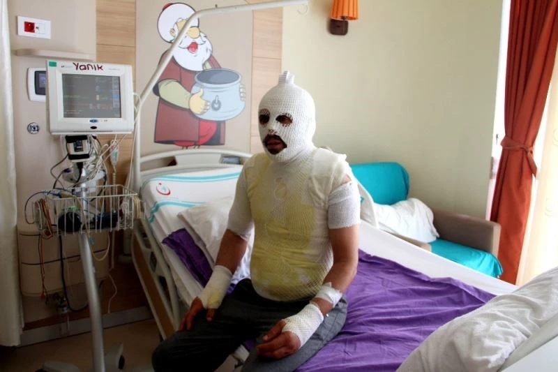 Akrabaları tarafından kaynar suyla yakıldığını iddia etti
