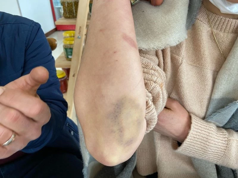 Beylikdüzü’nde hırsızları engellemeye çalışırken ölümden dönen karı-koca dehşet anlarını anlattı
