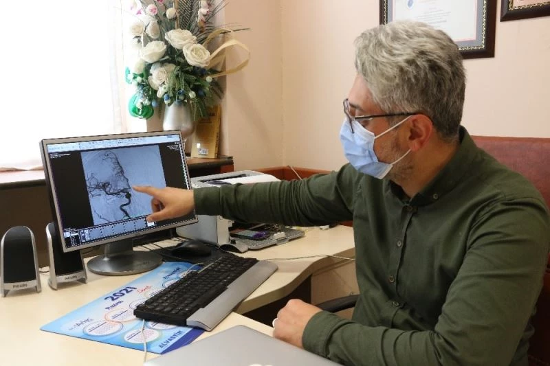 Her 6 saniyede 1 kişi inme geçiriyor, saatte 1 kişi hayatını kaybediyor
