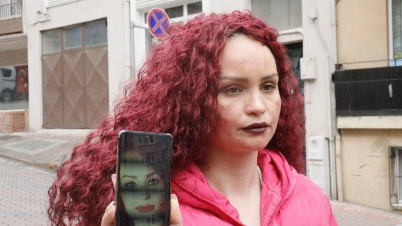 Yüzündeki lekeleri sildirmek için gitti, hayatının şokunu yaşadı
