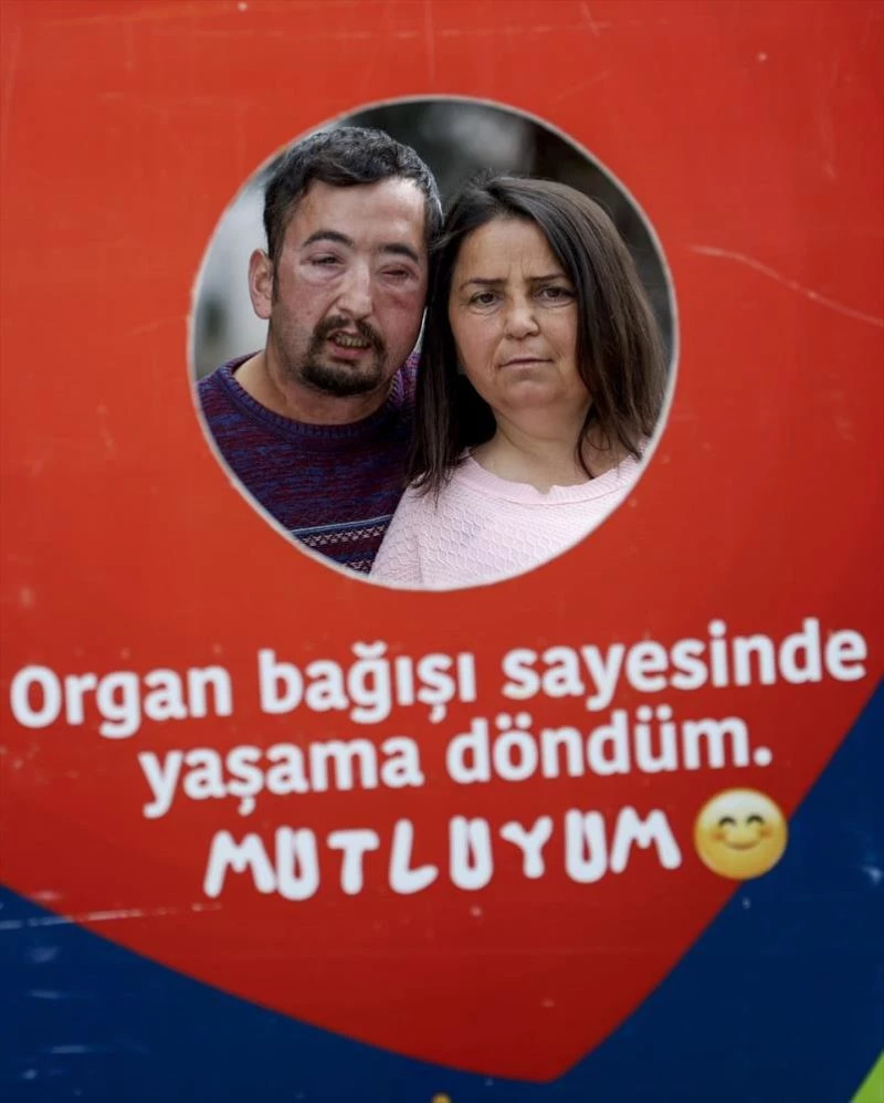 Biri yüz ve diğeri böbrek nakli olan çiftin hastane bahçesinde başlayan aşkları ilk günkü gibi sürüyor