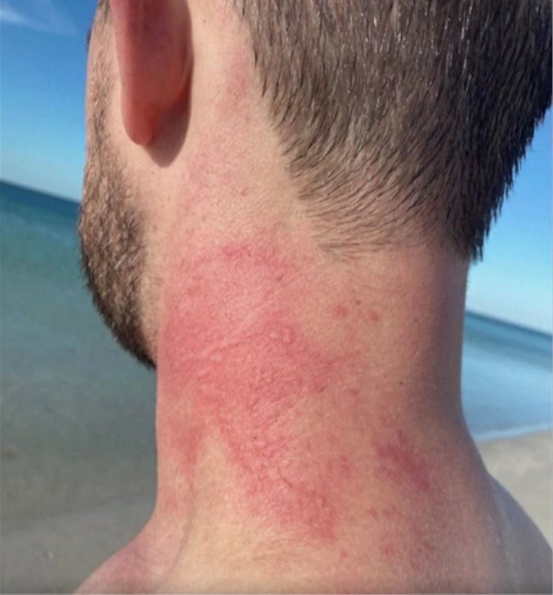 Avustralya’da yer bilimciye ahtapot saldırısı
