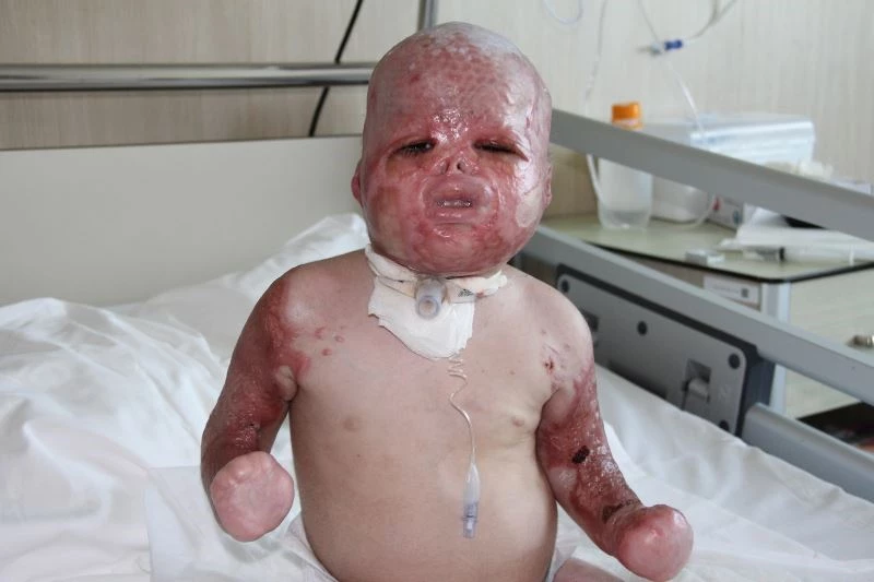 (Özel) Savaşın acı yüzü Delal bebeğin inanılmaz kurtuluşu
