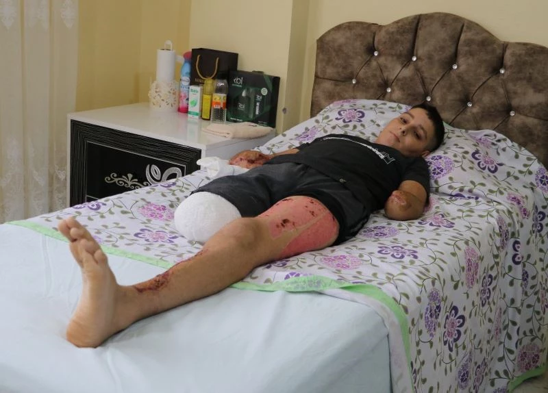 Uçurtması yüksek gerilim hattına takılan çocuk ölümden döndü
