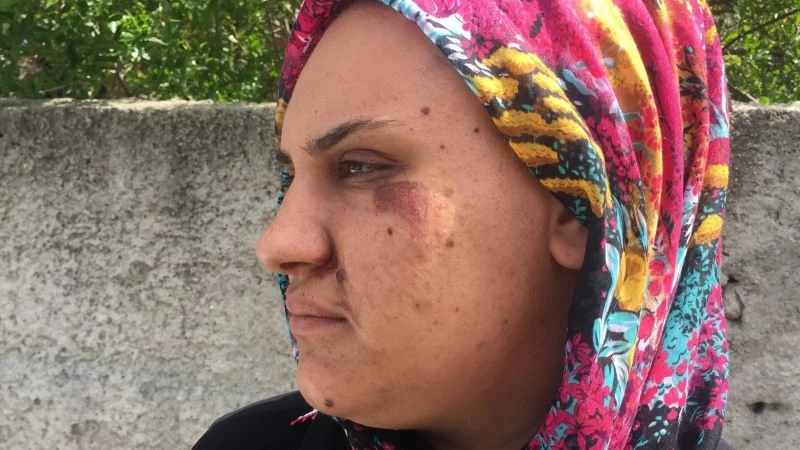 Kapkaççının sürüklediği kadın dehşet anlarını anlattı
