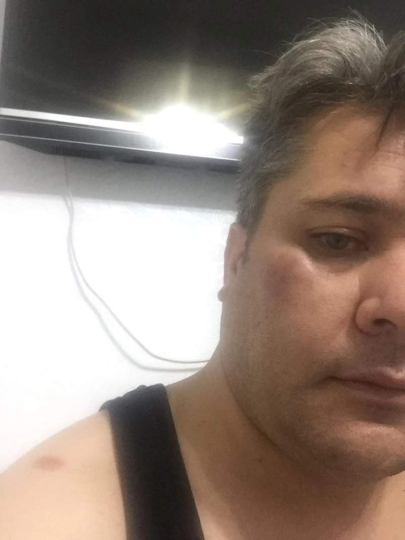 Haber takibindeki İHA muhabirine çirkin saldırı
